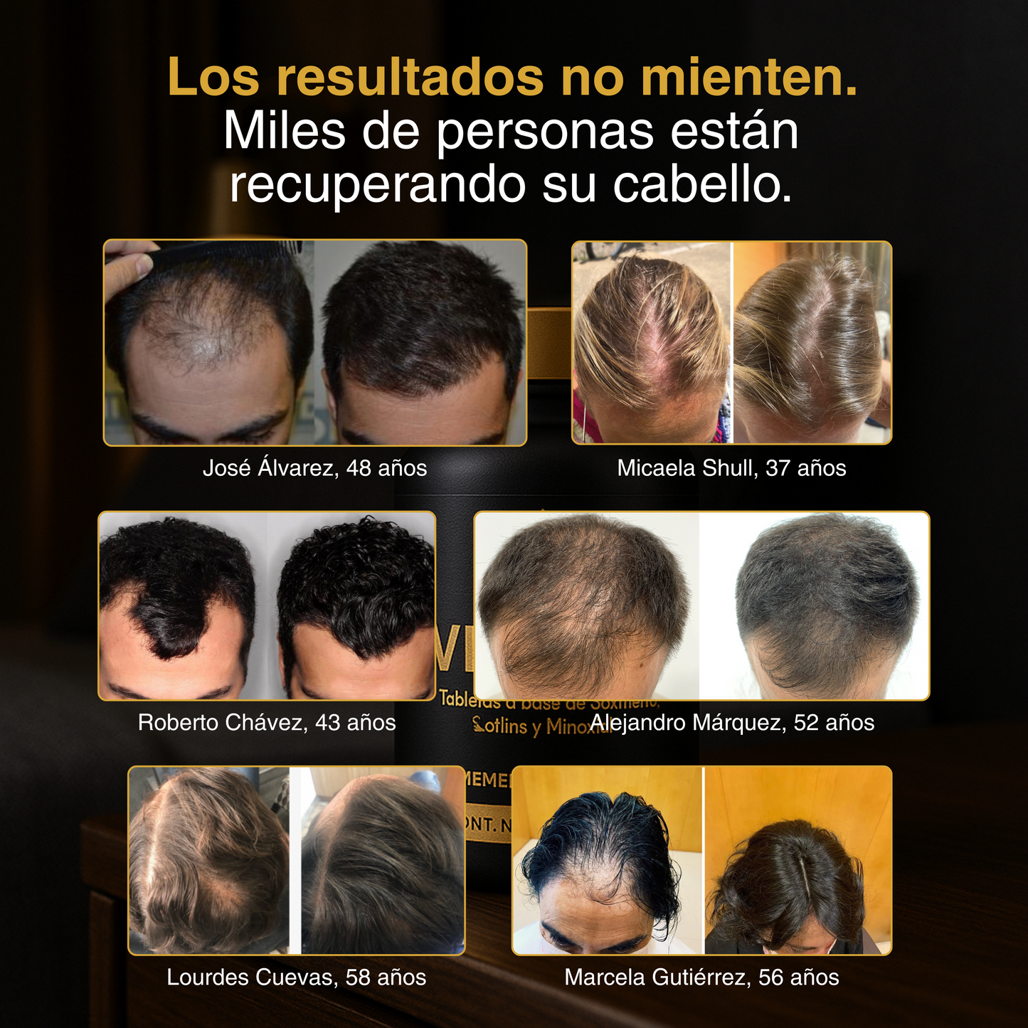 Vita-Pil - Recupera tu cabello en 90 días